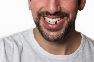 5 ways to replace a missing tooth